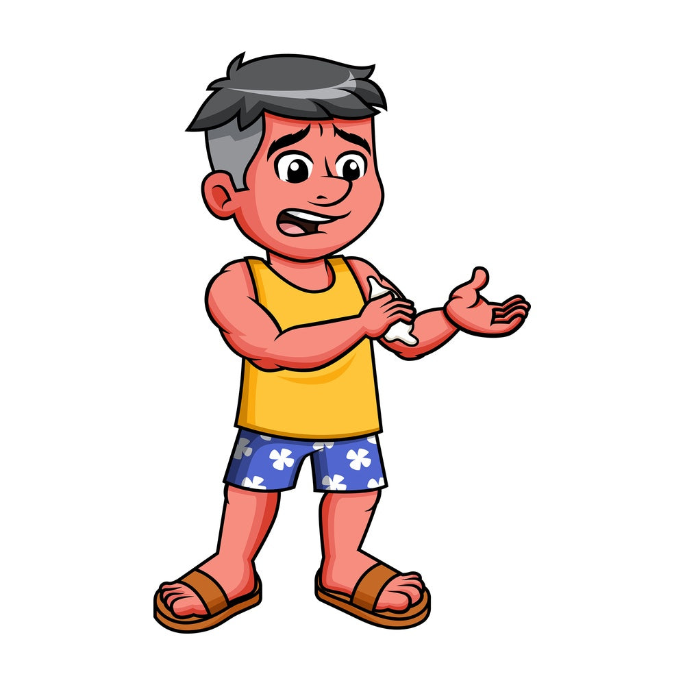 Guy with red skin from sunburn applying sunblock. PNG - JPG and vector EPS file formats.